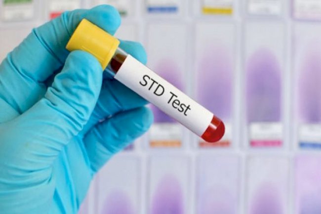 Here are important STD screening tests you must know about