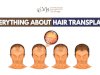 Wondering about the three main reasons behind the failure of hair transplantation?