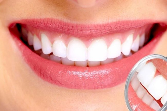 Pros and Cons of All-On-4 Dental Treatment