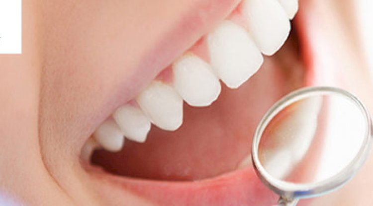 What are the Advantages of Having Whiter Teeth?