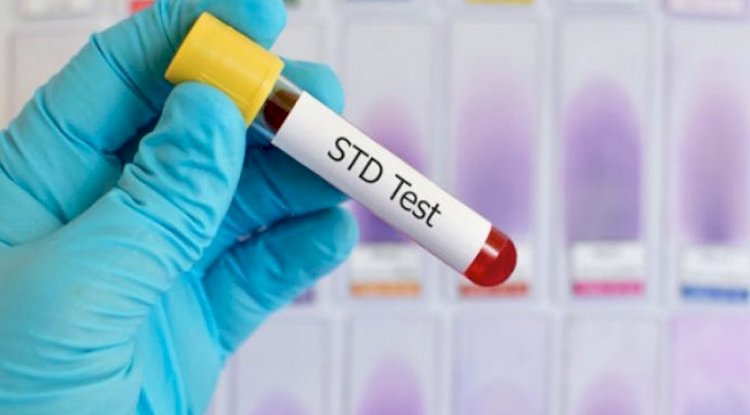 Here are important STD screening tests you must know about