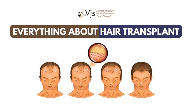 Wondering about the three main reasons behind the failure of hair transplantation?