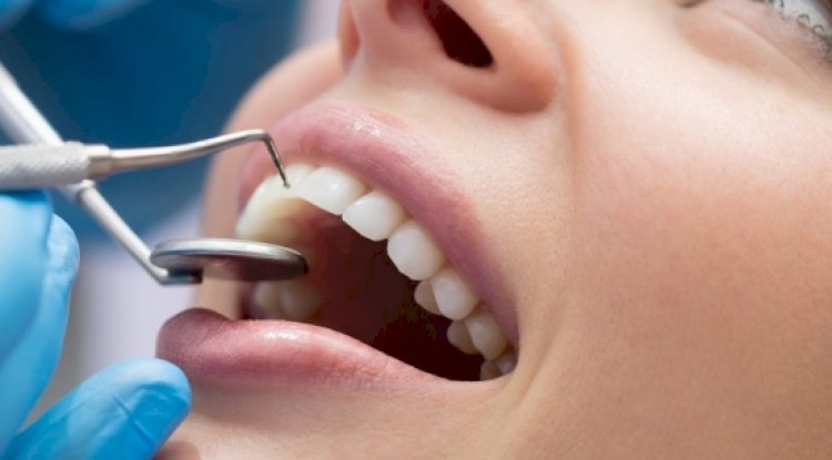 Is it Better to Go to a General Dentist or a Specialist?