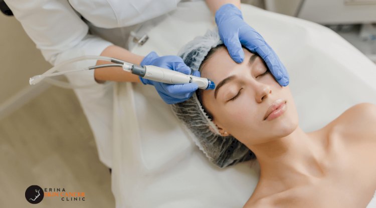 Experience Glowing and Radiant Skin with Laser Genesis!