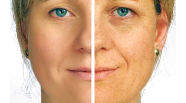 Unexpected Places That Expose You To Sun Damage