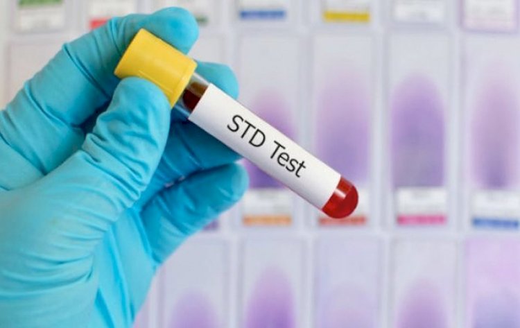 Here are important STD screening tests you must know about