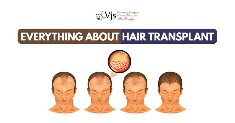 Wondering about the three main reasons behind the failure of hair transplantation?