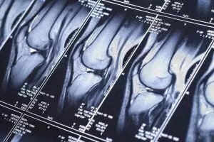 Knee MRI Scans in Santa Fe: How to Prepare and What to Expect